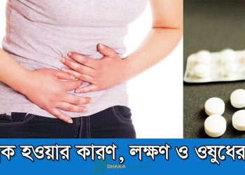 গ্যাস্ট্রিক হওয়ার কারণ-লক্ষণ ও ওষুধের নাম