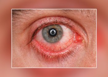 হঠাৎ করে চোখে না দেখার কারণ কি?